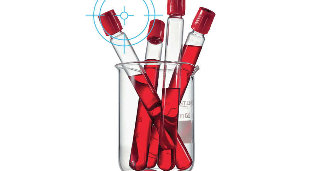 Hemoglobinúria paroxística noturna: Novo tra...