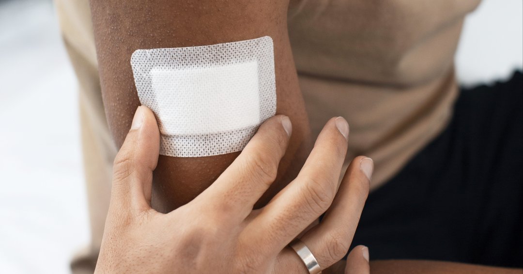 Adesivo anticoncepcional: como funciona e qu...