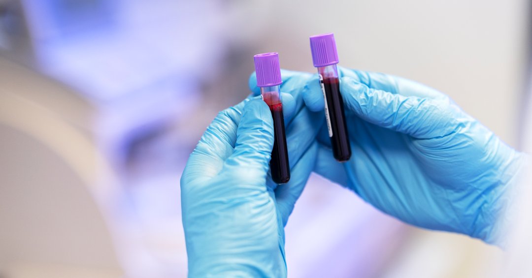 Eritrócitos altos no exame de sangue: entend...