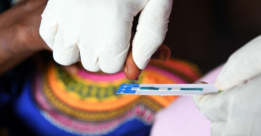 HIV: Mundo pode ter 6 milhões de mortes por...