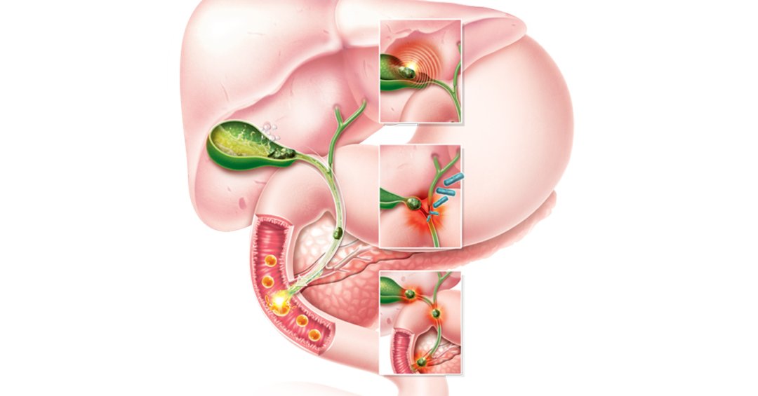 Não precisa de cirurgia? Esclareça 5 mitos s...