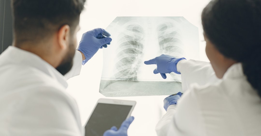 Pneumotórax: o que é, quais são as causas, s...