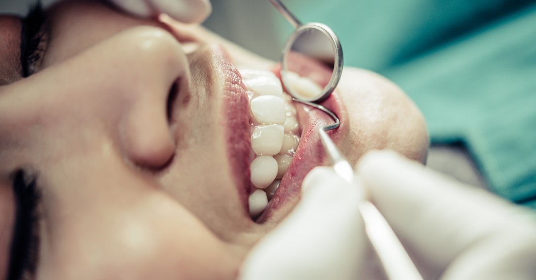 Restauração dental: saiba quando o procedime...