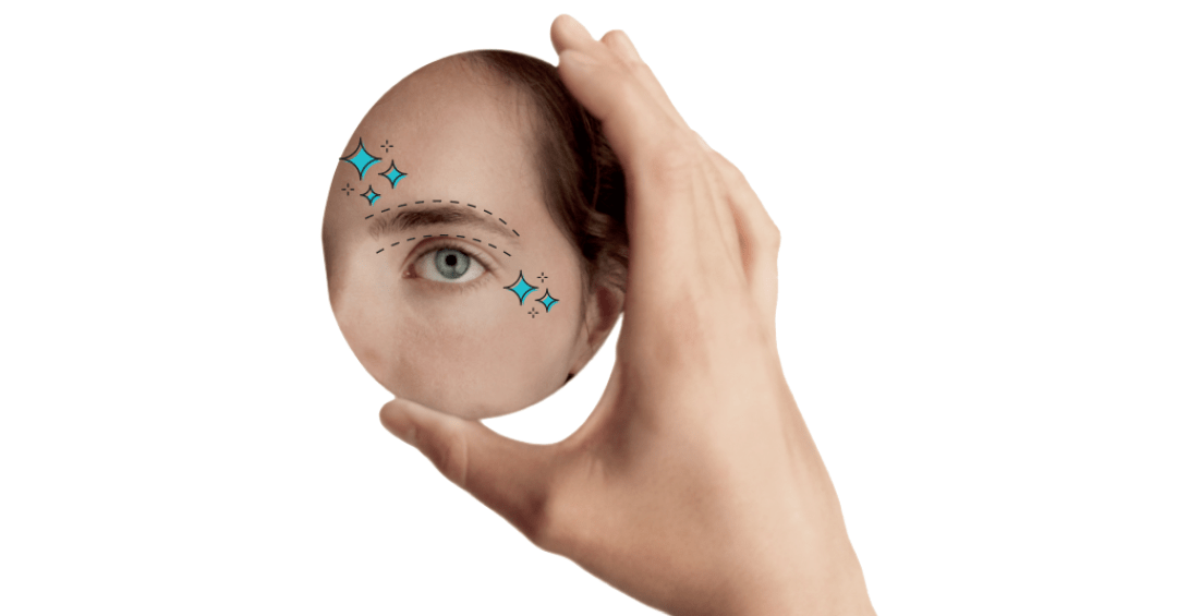 Transplante de sobrancelha: vale a pena inve...