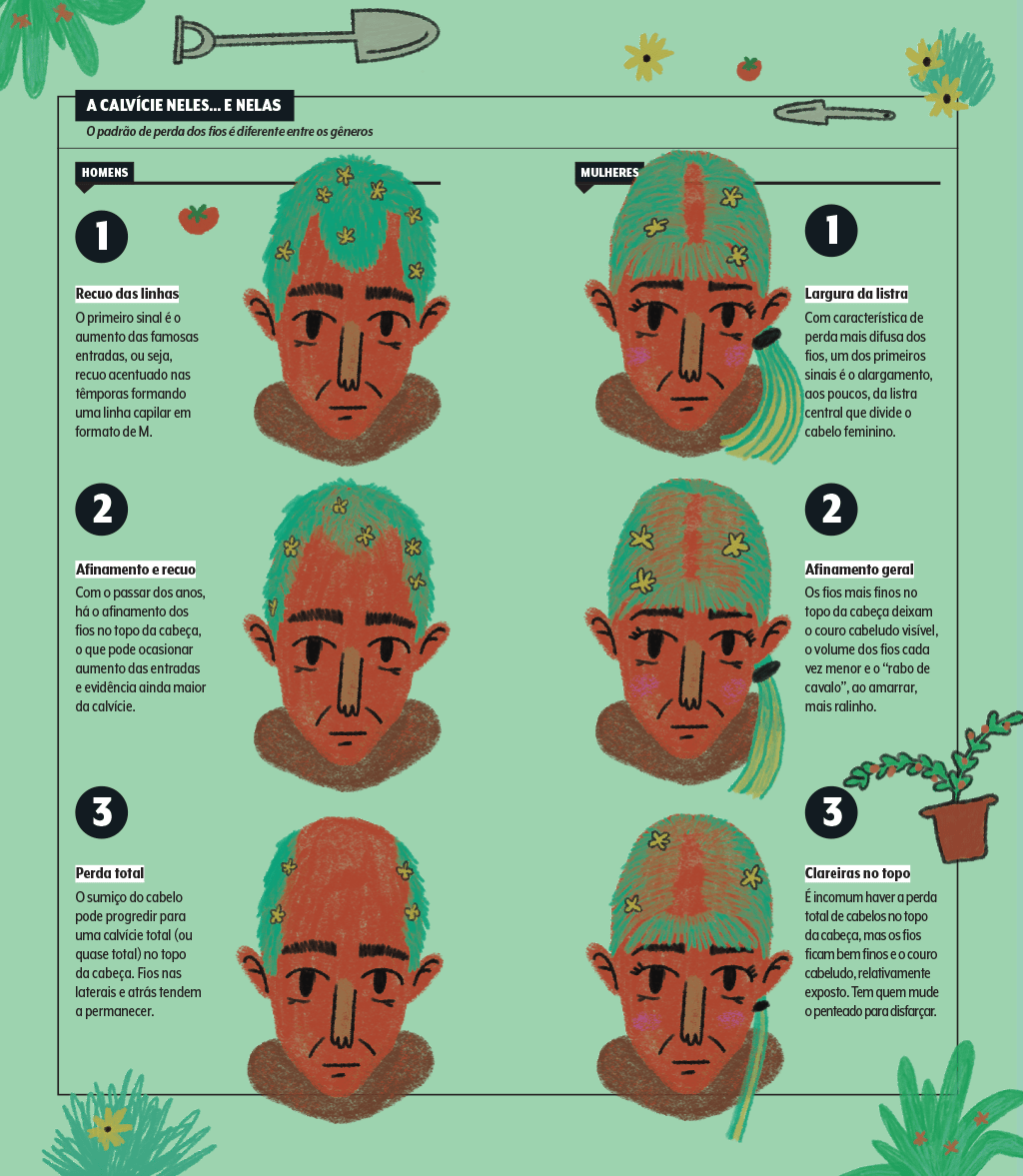 materia-terapias-capilares-calvicie-quadro-comparativo-padroes-masculino-feminino