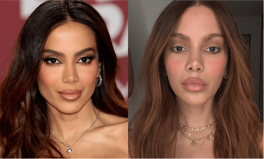 Anitta-lifting-novo-rosto