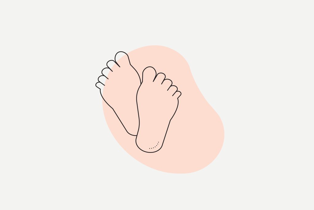 pesquisa-fenilcetonuria