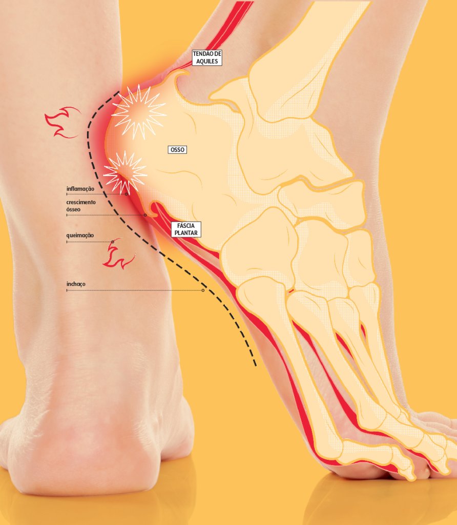 esporao-como-acontece