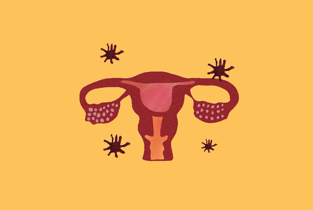 Ilustração representando útero