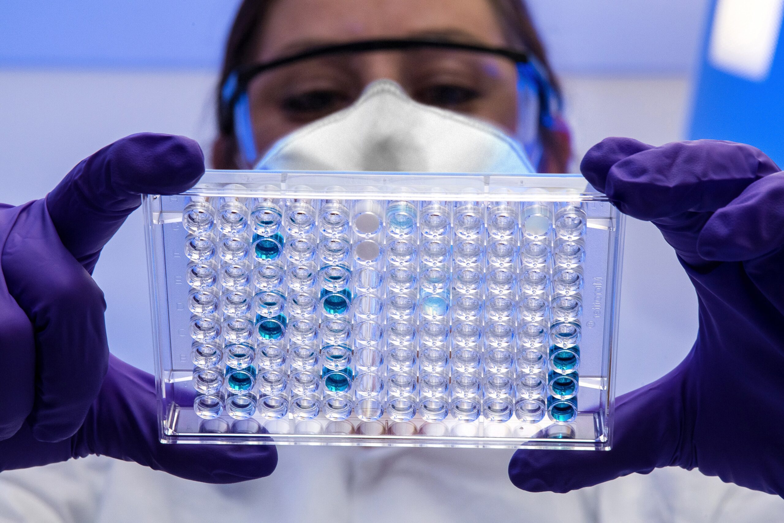 Amiloidose hereditária: consulta pública discute tratamento no SUS